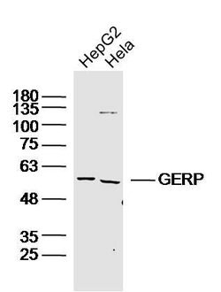 RNF27 Rabbit anti-Human, Polyclonal, Bioss 100 &mu;L; Unconjugated:Antibodies,