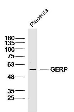 RNF27 Rabbit anti-Human, Polyclonal, Bioss 100 &mu;L; Unconjugated:Antibodies,