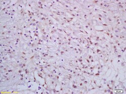 CRSP complex subunit 7/ARC70 Rabbit anti-Human, Polyclonal, Bioss 100 &mu;L;