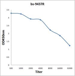 FAR1 Rabbit anti-Human, Polyclonal, Bioss 100 &mu;L; Unconjugated:Antibodies,