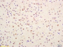 AMPK gamma 1/2/3 Rabbit anti-Human, Polyclonal, Bioss 100 &mu;L; Unconjugated:Antibodies,