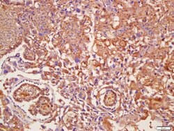AMPK gamma 1/2/3 Rabbit anti-Human, Polyclonal, Bioss 100 &mu;L; Unconjugated:Antibodies,
