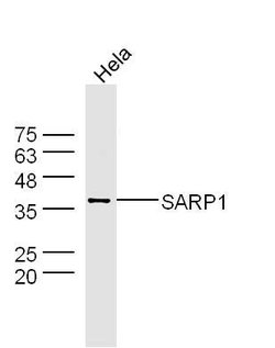 SARP1 Rabbit anti-Human, Polyclonal, Bioss 100 &mu;L; Unconjugated:Antibodies,