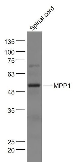 MPP1 Rabbit anti-Human, Polyclonal, Bioss 100 &mu;L; Unconjugated:Antibodies,