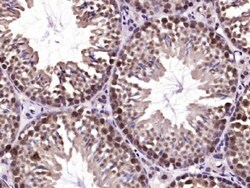 SHARPIN Rabbit anti-Human, Polyclonal, Bioss 100 &mu;L; Unconjugated:Antibodies,