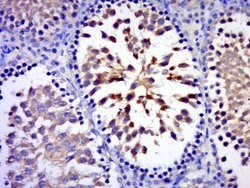 C17orf75 Rabbit anti-Human, Polyclonal, Bioss 100 &mu;L; Unconjugated:Antibodies,