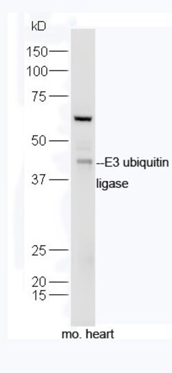 E3 ubiquitin ligase Rabbit anti-Human, Polyclonal, Bioss 100 &mu;L; Unconjugated:Antibodies,