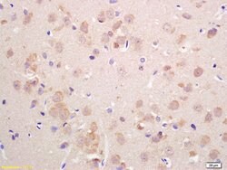 VGLUT2 Rabbit anti-Human, Polyclonal, Bioss 100 &mu;L; Unconjugated:Antibodies,