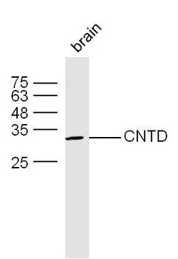 CNTD Rabbit anti-Human, Polyclonal, Bioss 100 &mu;L; Unconjugated:Antibodies,