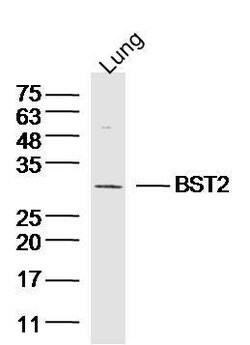 BST2/CD317 Rabbit anti-Human, Polyclonal, Bioss 100 &mu;L; Unconjugated:Antibodies,