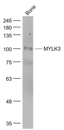 MYLK3 Rabbit anti-Human, Polyclonal, Bioss 100 &mu;L; Unconjugated:Antibodies,