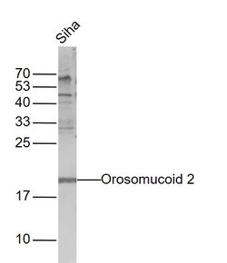 Orosomucoid 2 Rabbit anti-Human, Polyclonal, Bioss 100 &mu;L; Unconjugated:Antibodies,