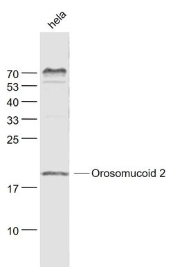 Orosomucoid 2 Rabbit anti-Human, Polyclonal, Bioss 100 &mu;L; Unconjugated:Antibodies,