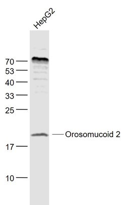 Orosomucoid 2 Rabbit anti-Human, Polyclonal, Bioss 100 &mu;L; Unconjugated:Antibodies,