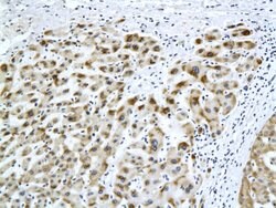 HBsAg Mouse anti-Human, Clone: H2F4, Bioss 100 &mu;L; Unconjugated:Antibodies,