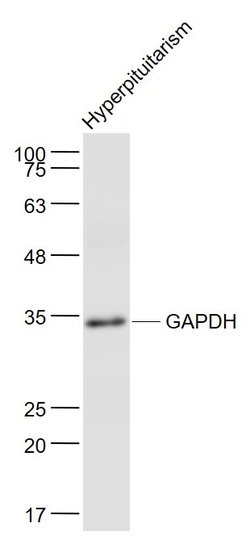 GAPDH Mouse anti-Human, Clone: 4F8, Bioss 100 &mu;L; Unconjugated:Antibodies,