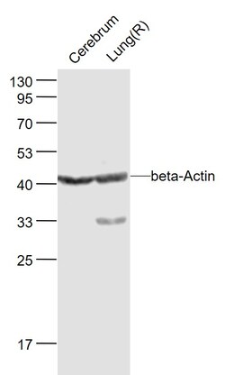 beta-Actin Monoclonal Antibody (1A2), Bioss 100 &mu;L | Buy Online | Bioss | Fisher Scientific