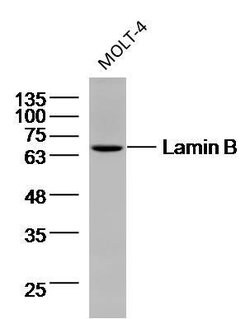 Lamin B Mouse anti-Human, Clone: 9C11, Bioss 100 &mu;L; Unconjugated:Antibodies,