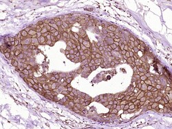 C-erbB-2/HER2 Monoclonal Antibody (13H9), Bioss 100 &mu;L; Unconjugated:Antibodies,