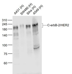 C-erbB-2/HER2 Monoclonal Antibody (13H9), Bioss 100 &mu;L; Unconjugated:Antibodies,