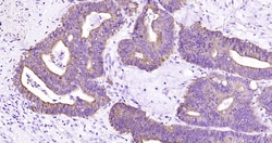 CK18 Monoclonal Antibody (10H2), Bioss 100 &mu;L; Unconjugated:Antibodies,