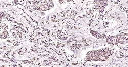 CK18 Monoclonal Antibody (10H2), Bioss 100 &mu;L; Unconjugated:Antibodies,