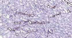 CK18 Monoclonal Antibody (10H2), Bioss 100 &mu;L; Unconjugated:Antibodies,
