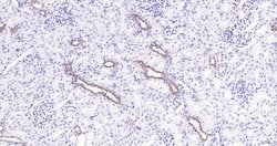 CK18 Monoclonal Antibody (10H2), Bioss 100 &mu;L; Unconjugated:Antibodies,