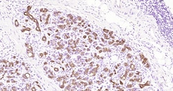 CK18 Monoclonal Antibody (10H2), Bioss 100 &mu;L; Unconjugated:Antibodies,