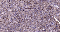 CK18 Monoclonal Antibody (10H2), Bioss 100 &mu;L; Unconjugated:Antibodies,