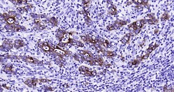 CK18 Monoclonal Antibody (10H2), Bioss 100 &mu;L; Unconjugated:Antibodies,