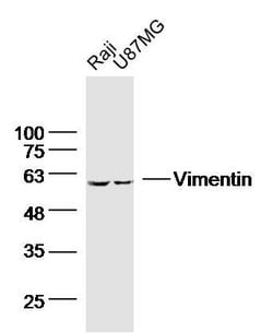 Vimentin Mouse anti-Human, Clone: 3B7, Bioss 100 &mu;L; Unconjugated:Antibodies,