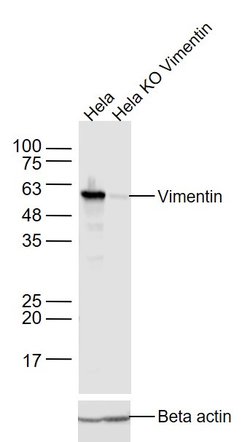 Vimentin Mouse anti-Human, Clone: 3B7, Bioss 100 &mu;L; Unconjugated:Antibodies,