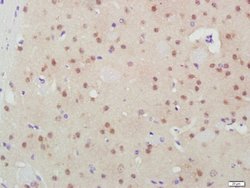 GSK3B Mouse anti-Human, Clone: 3A6, Bioss 100 &mu;L | Buy Online | Bioss | Fisher Scientific