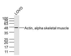Actin, alpha skeletal muscle Mouse anti-Human, Clone: 5F11, Bioss 100 &mu;L;