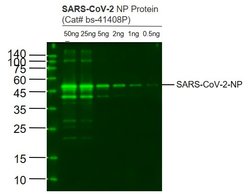SARS-CoV-2 Nucleocapsid Protein Monoclonal Antibody (1C7), Bioss 100 &mu;g;