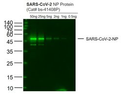 SARS-CoV-2 Nucleocapsid Protein Monoclonal Antibody (7E1B), Bioss 100 &mu;L | Buy Online | Bioss | Fisher Scientific
