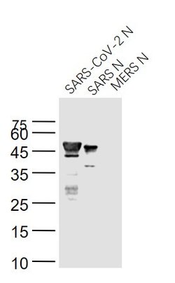 SARS Nucleocapsid Protein Monoclonal Antibody (5C6C), Bioss 100 &mu;L;