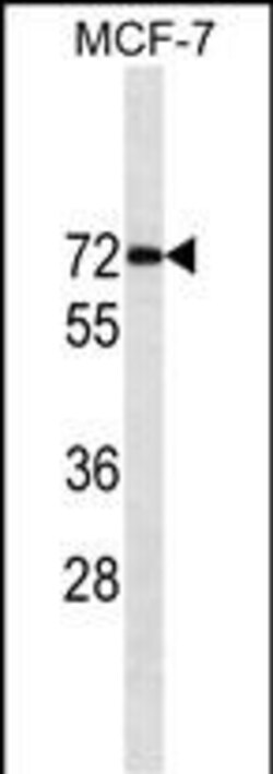 ESR1/ER Monoclonal Antibody (5C1), Bioss 100 &mu;L; Unconjugated:Antibodies,