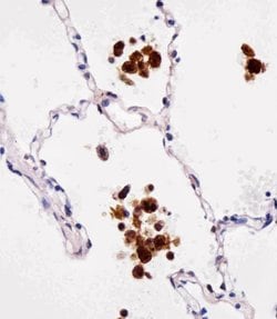 FABP4 Mouse anti-Human, Clone: 5C1, Bioss 100 &mu;L; Unconjugated:Antibodies,