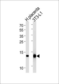 FABP4 Mouse anti-Human, Clone: 5C1, Bioss 100 &mu;L; Unconjugated:Antibodies,