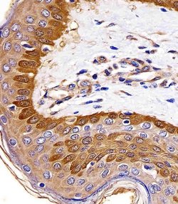 S100A2 Mouse anti-Human, Clone: 2C1, Bioss 100 &mu;L; Unconjugated:Antibodies,