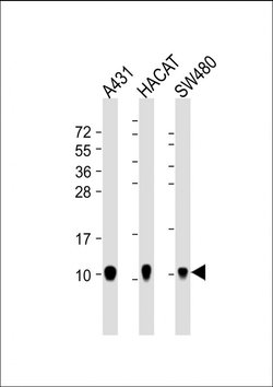 S100A2 Mouse anti-Human, Clone: 2C1, Bioss 100 &mu;L; Unconjugated:Antibodies,