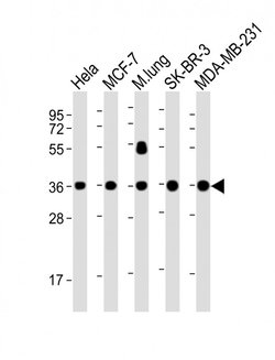 WNT4 Mouse anti-Human, Clone: 8C5, Bioss 100 &mu;L; Unconjugated:Antibodies,