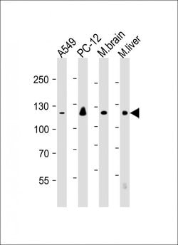 EIF2AK3 Mouse anti-Human, Clone: 3C3, Bioss 100 &mu;L; Unconjugated:Antibodies,