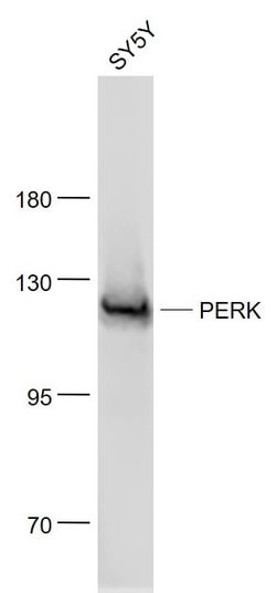 EIF2AK3 Mouse anti-Human, Clone: 3C3, Bioss 100 &mu;L; Unconjugated:Antibodies,