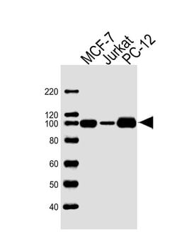 TOP1 Mouse anti-Human, Clone: 1C6, Bioss 100 &mu;L; Unconjugated:Antibodies,