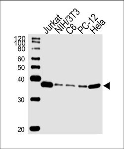 RAD51 Mouse anti-Human, Clone: 1C9, Bioss 100 &mu;L; Unconjugated:Antibodies,