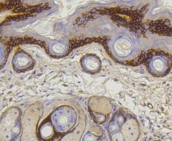 Collagen 17 Rabbit anti-Human, Clone: 1C11, Bioss 100 &mu;L; Unconjugated:Antibodies,