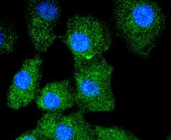 Cytokeratin 13 Rabbit anti-Human, Clone: 5A3, Bioss 100 &mu;L; Unconjugated:Antibodies,